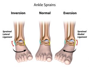 Ankle Pain