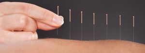 Medical Acupuncture