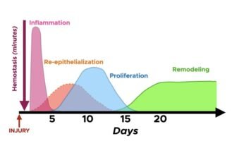 The 4 Stages of Tissue Healing: How Long Does an Injury Take to Heal?